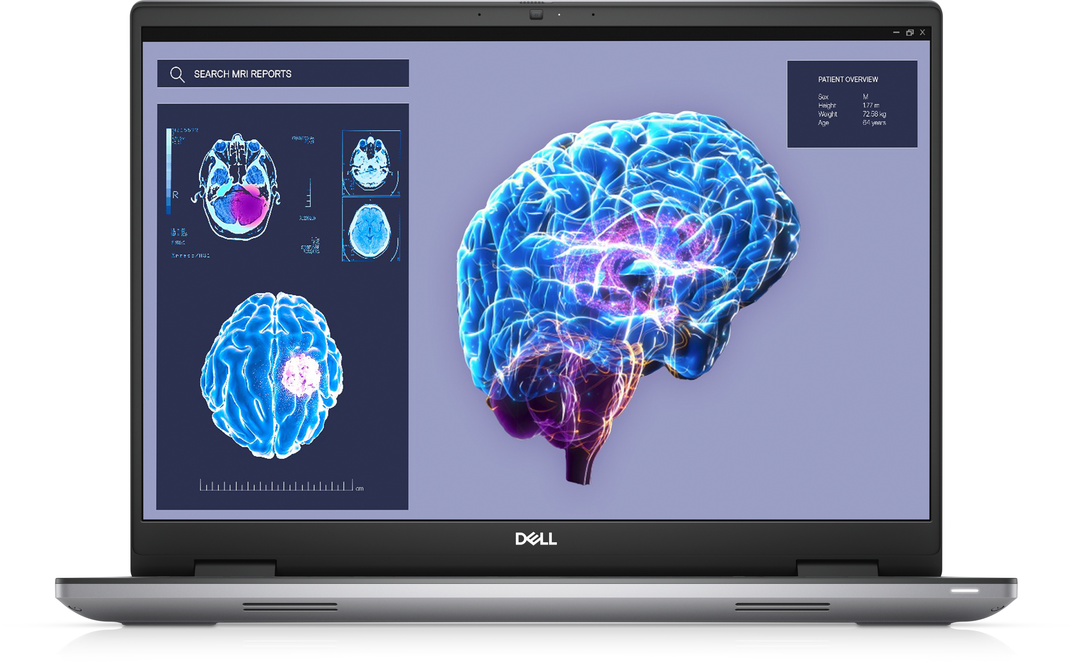 DELL Station de travail mobile Precision 7680 i7-13850HX 32 Go RAM 1 To SSD RTX 2000 QWERTY