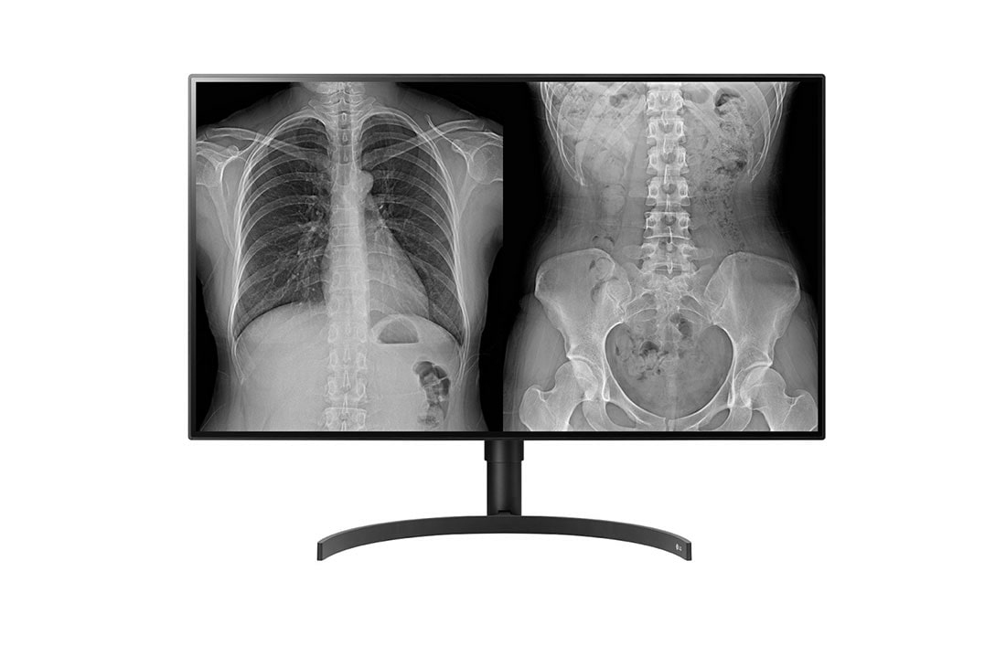 LG LG 32