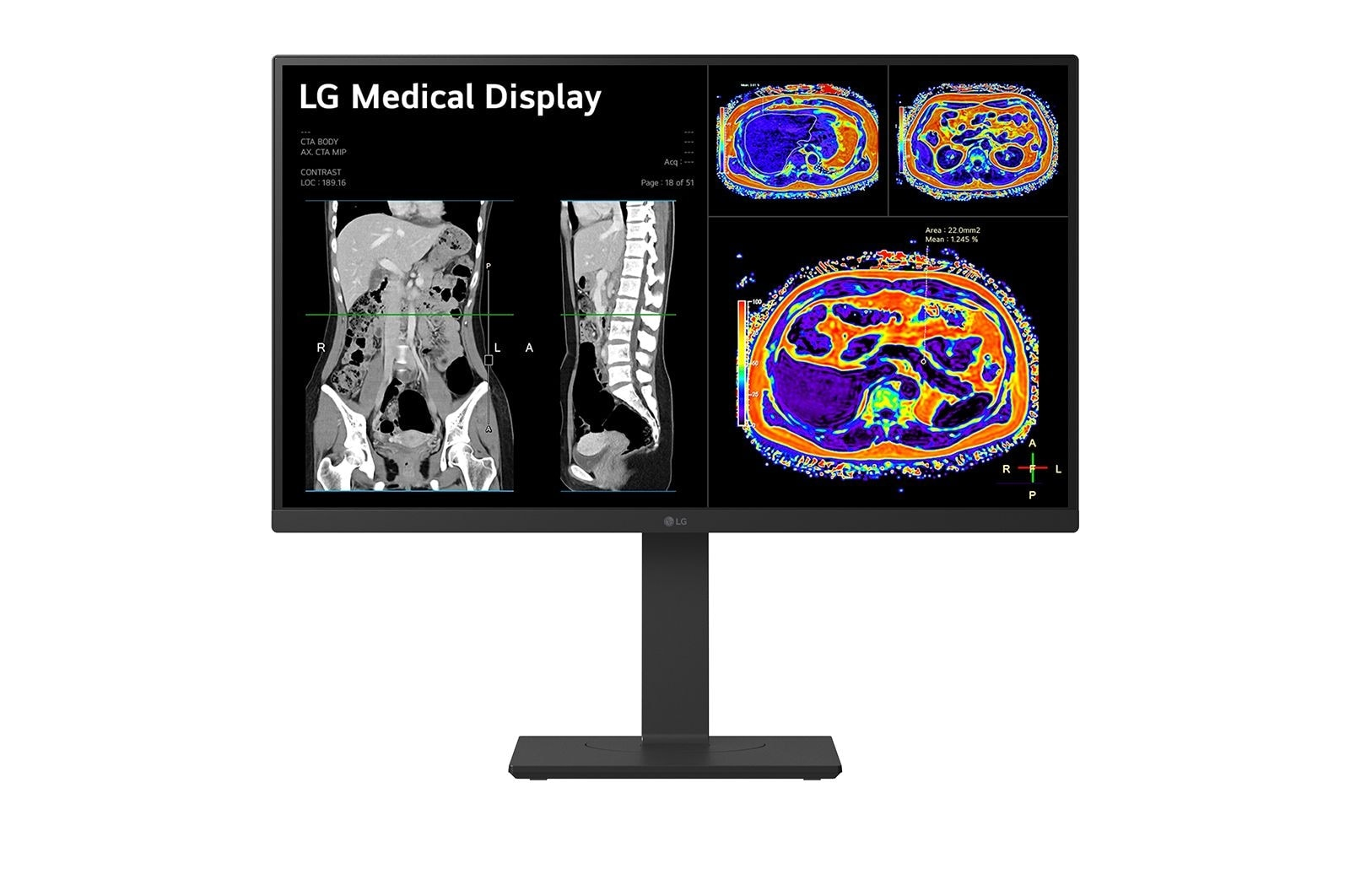 LG ical 27 pouces Dalle IPS 8MP 4K UHD</name> Actually, let's stick closer to the provided example structure. Example 1: <
