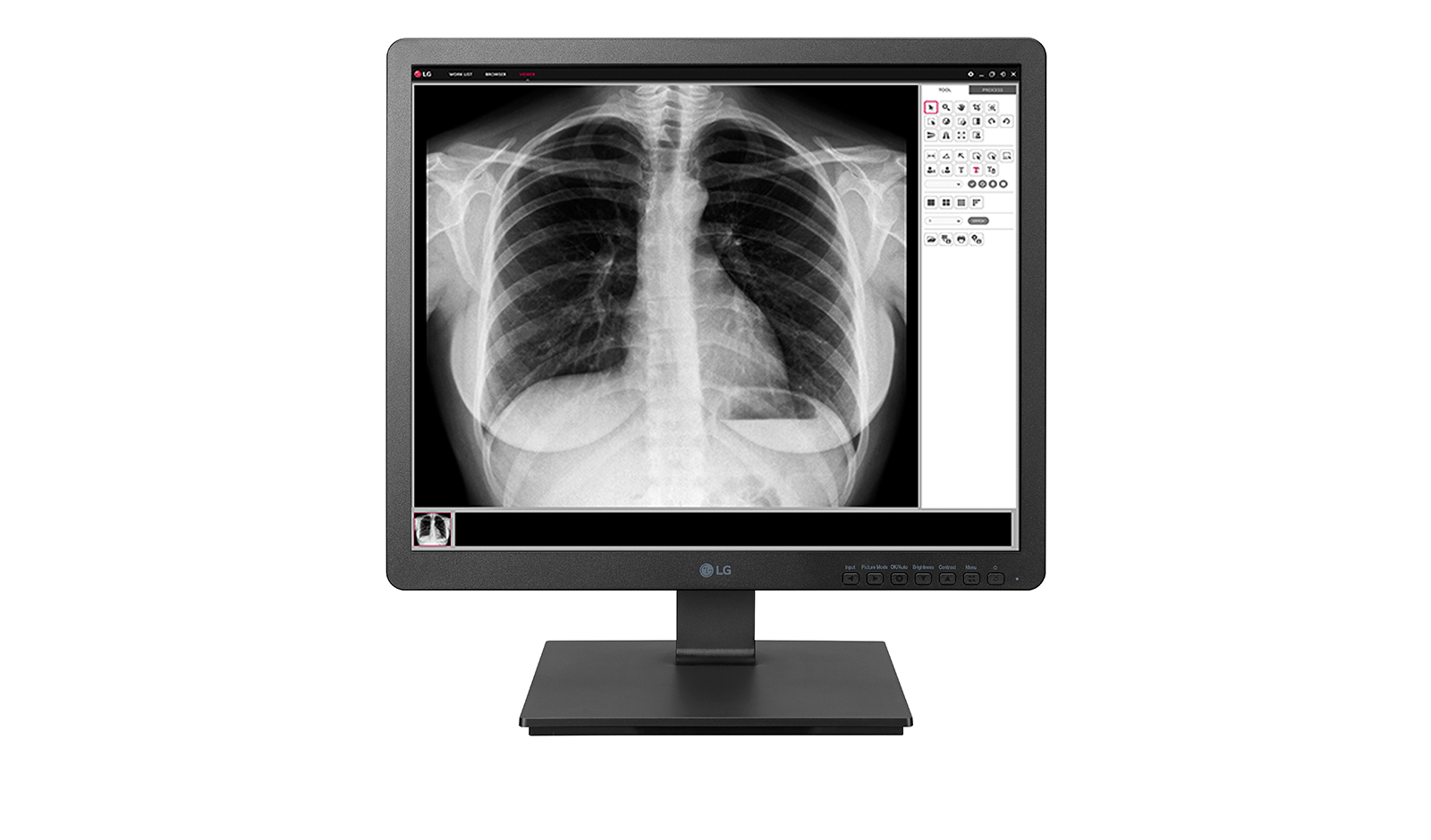 LG ECRAN 19 NOIR IPS 1.3MP 330cd/m 14ms 1280x1024 SRGB 72% HDMI Displayport D